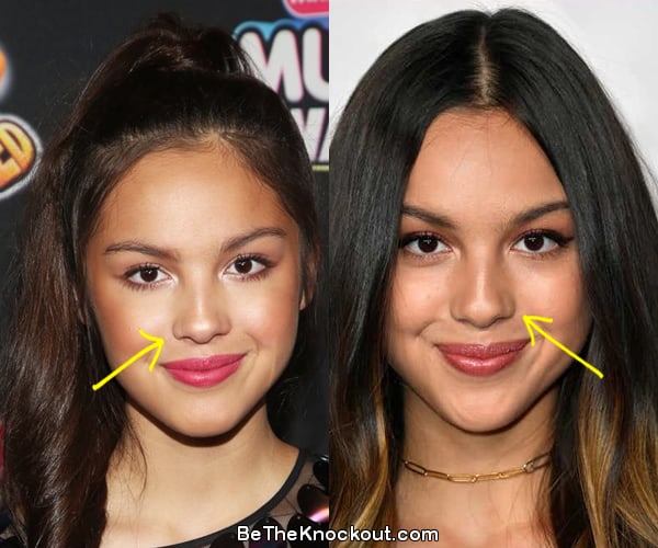Olivia Rodrigo nose job before and after comparison photo