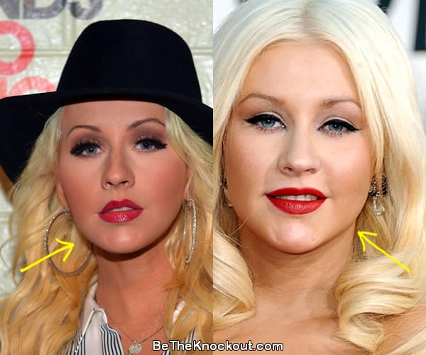 Christina Aguilera botox before and after comparison photo