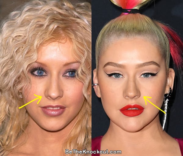 Christina Aguilera nose job before and after comparison photo