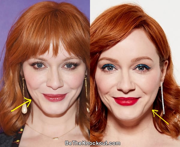 Christina Hendricks botox before and after comparison photo