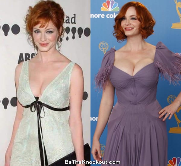 Christina Hendricks breast implants before and after comparison photo
