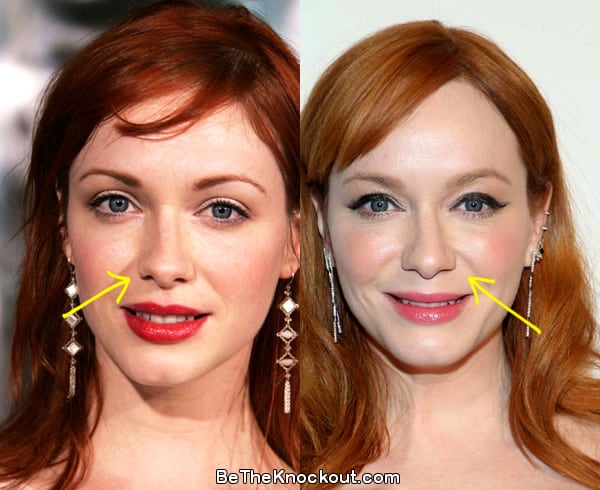 Christina Hendricks nose job before and after comparison photo