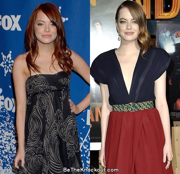 Emma Stone boob job before and after comparison photo