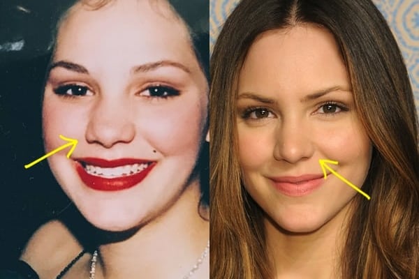Katharine Mcphee nose job before and after comparison photo