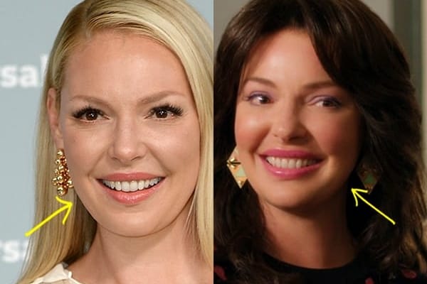 Katherine Heigl botox before and after comparison photo