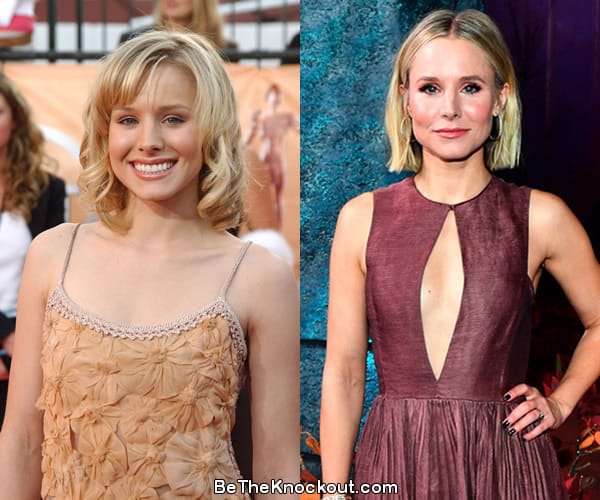 Kristen Bell boob job before and after comparison photo