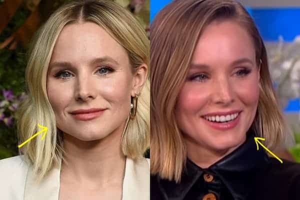 Kristen Bell botox before and after comparison photo