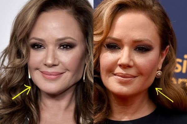 Leah Remini botox before and after comparison photo