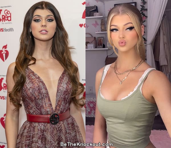 Loren Gray boob job before and after comparison photo