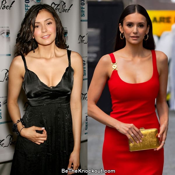 Nina Dobrev boob job before and after comparison photo