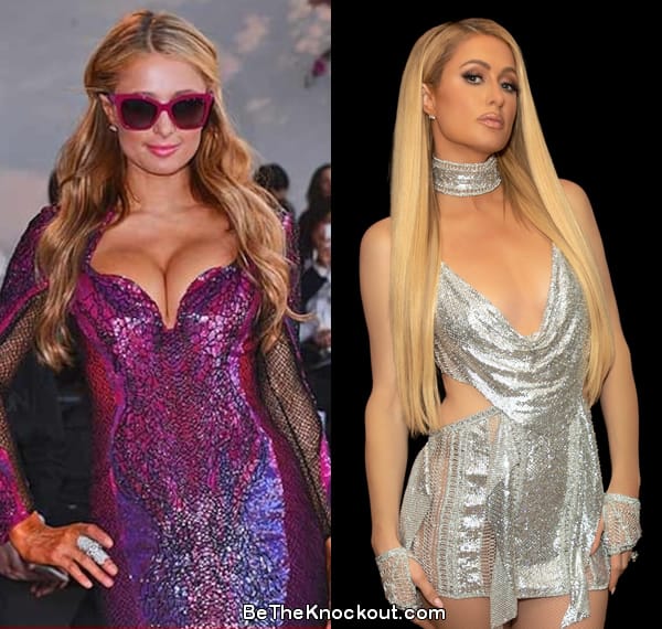 Paris Hilton boob job before and after comparison photo